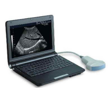 Equipo médico portátil escáner de ultrasonido portátil Digital